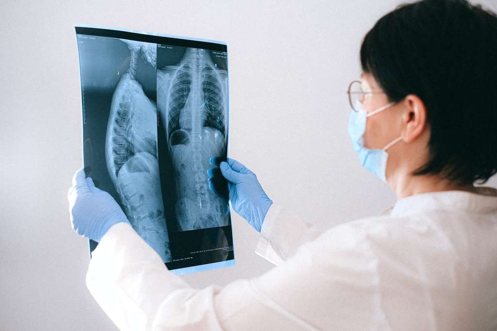 Chest x-ray to detect tuberculosis